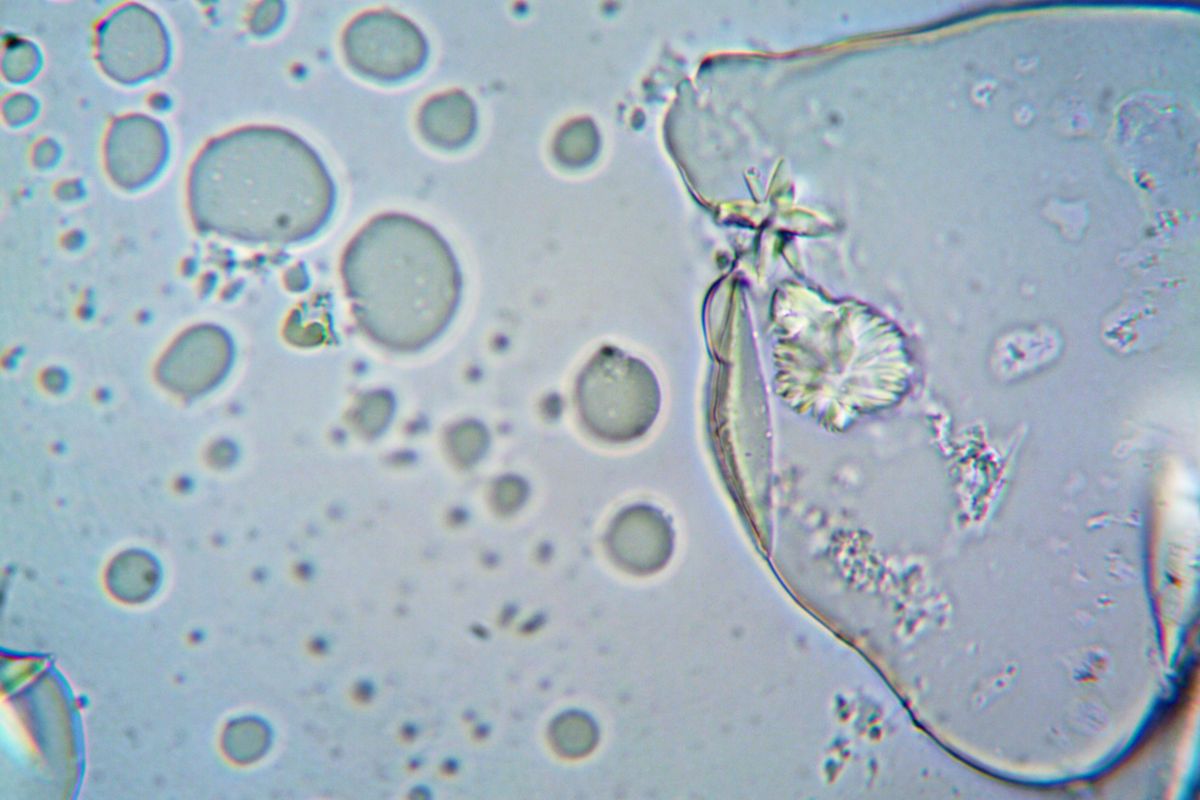 A magnified image showing cellular structure under a microscope