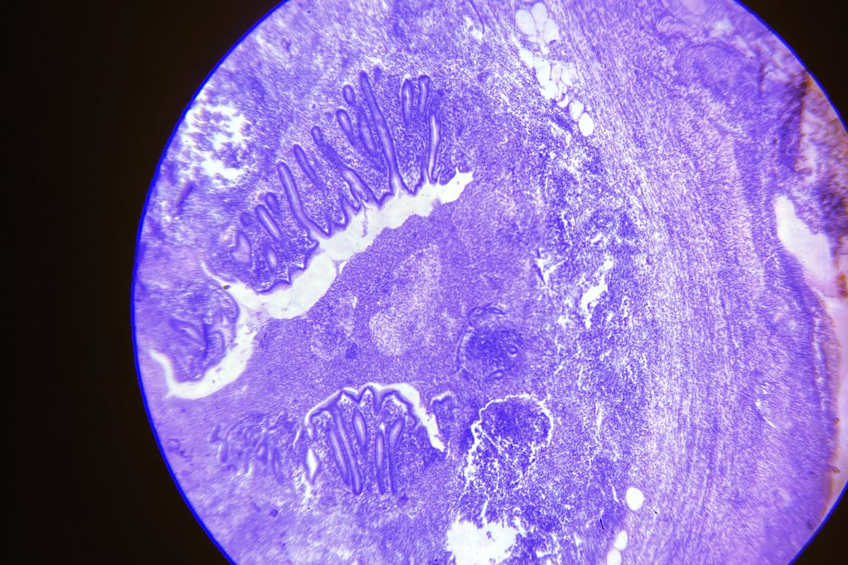 A stained tissue sample viewed under a microscope